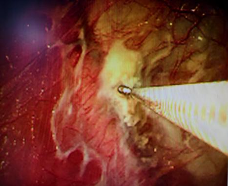 3f34eb2d81a816b8ae8ba1e8fa7f7a8